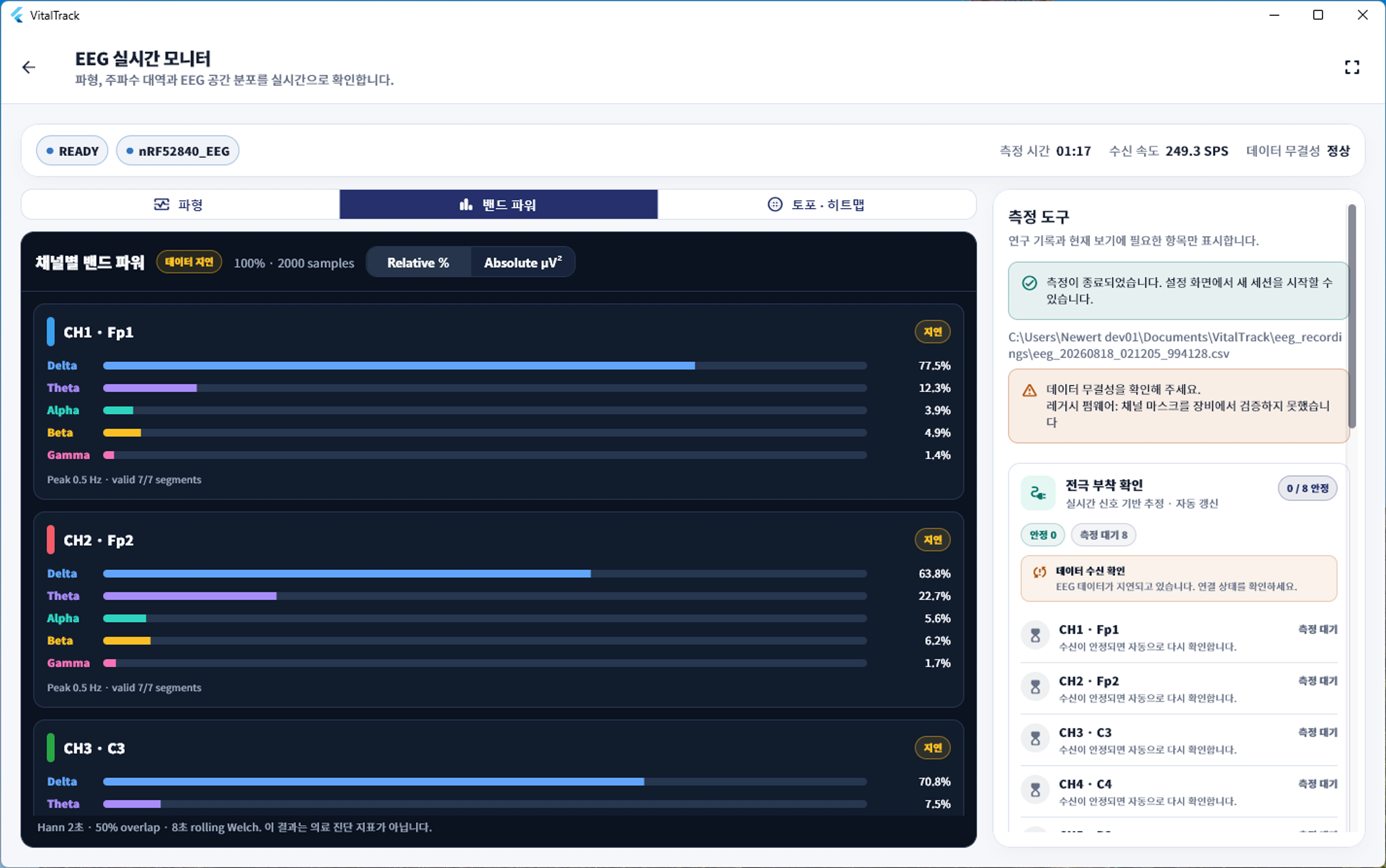 VitalTrack EEG 앱의 채널별 밴드파워 분석 화면
