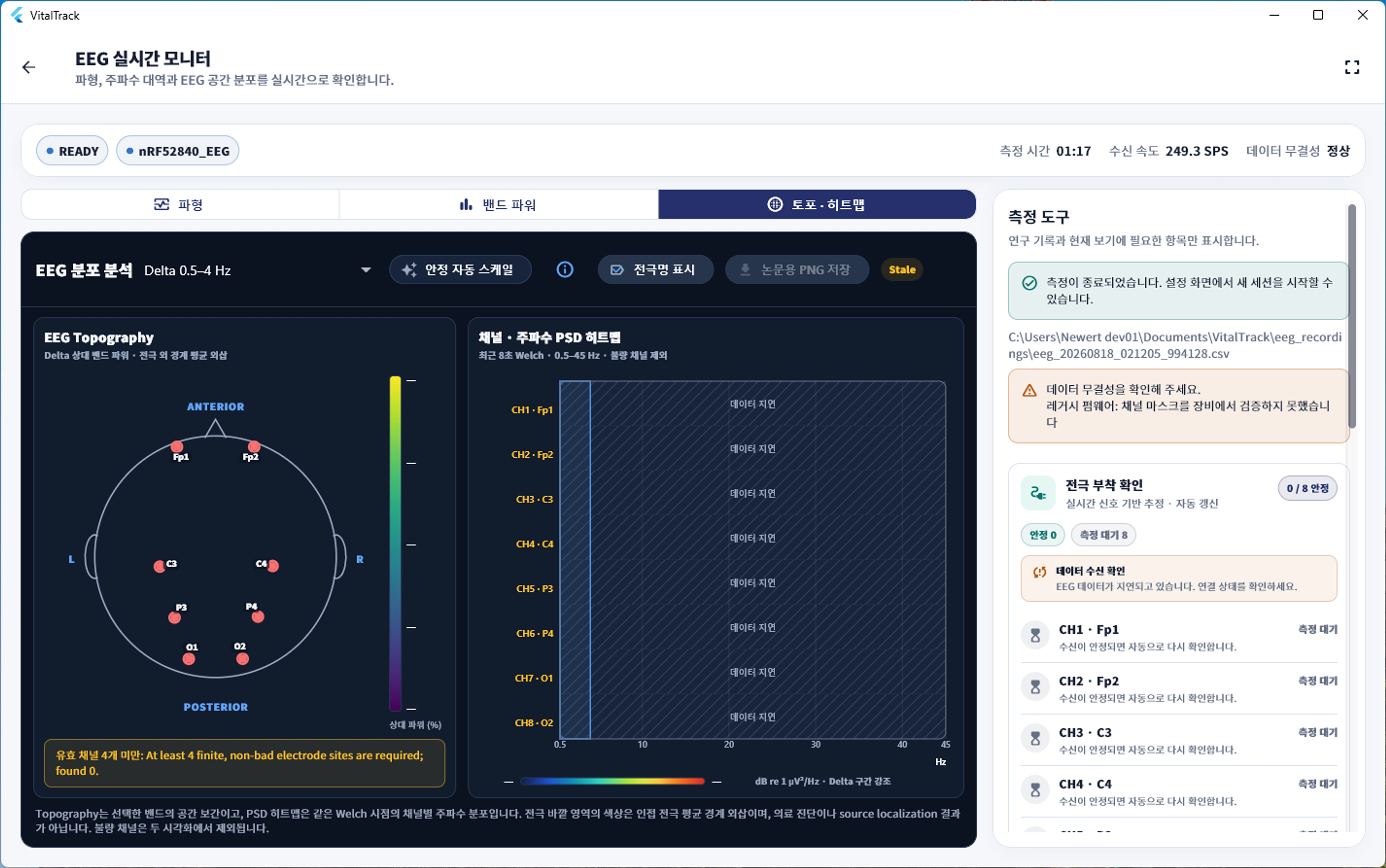 VitalTrack EEG 앱의 두피 토포그래피와 PSD 히트맵 화면