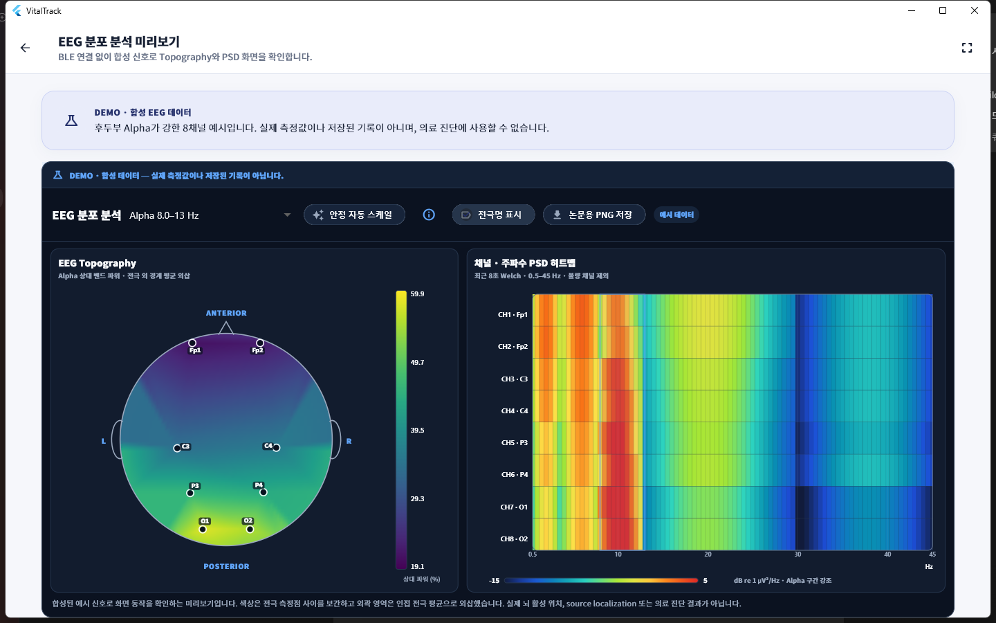 VitalTrack EEG 앱의 EEG 분포 분석 미리보기 화면