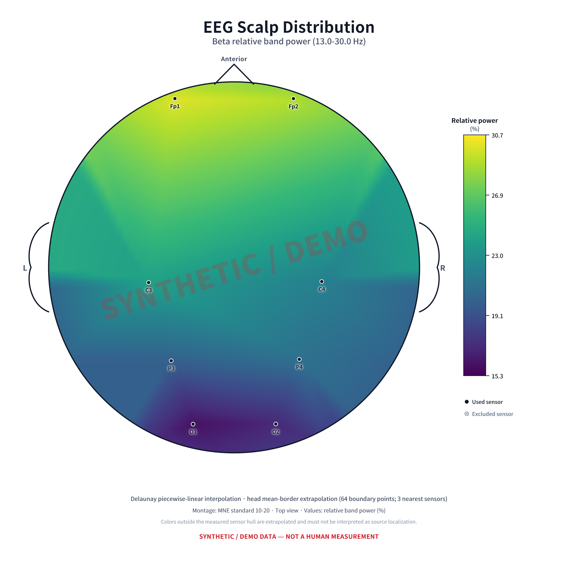 Publication-ready EEG scalp-distribution PNG saved from VitalTrack EEG