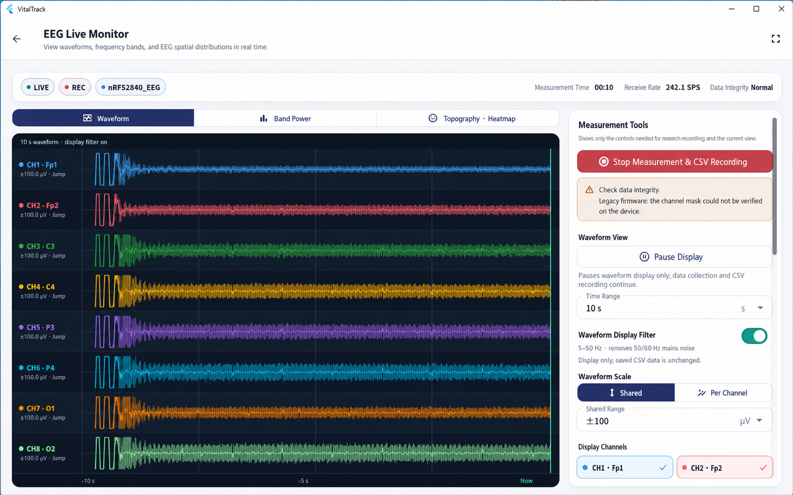Live eight-channel waveform monitor in the VitalTrack EEG app