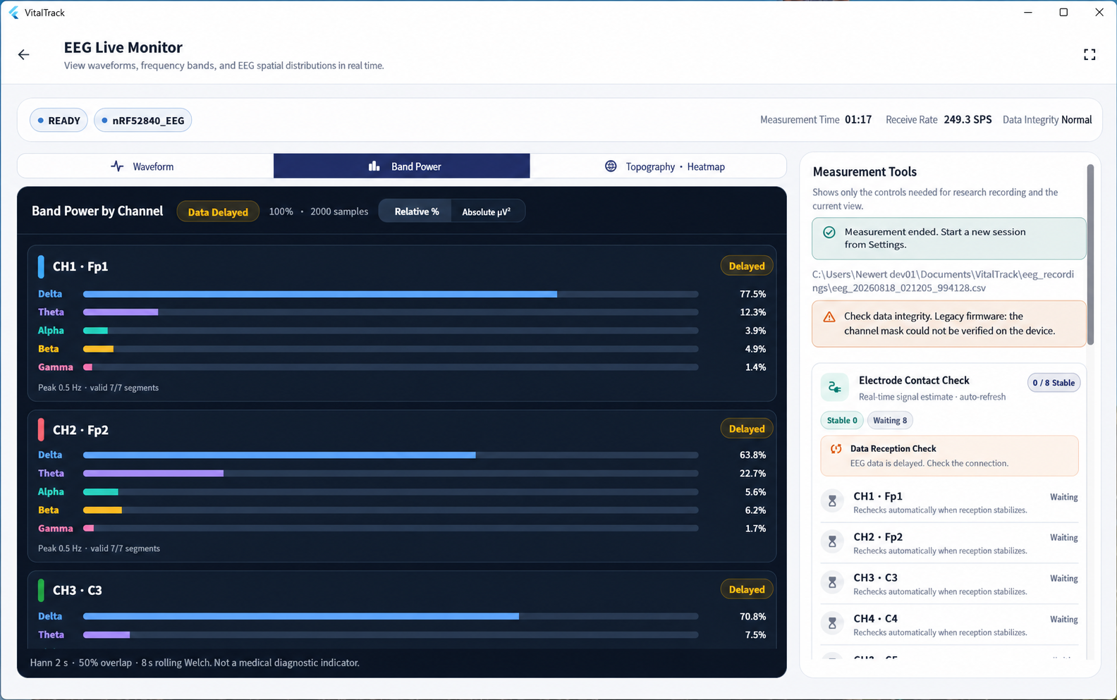 Channel band-power analysis in the VitalTrack EEG app