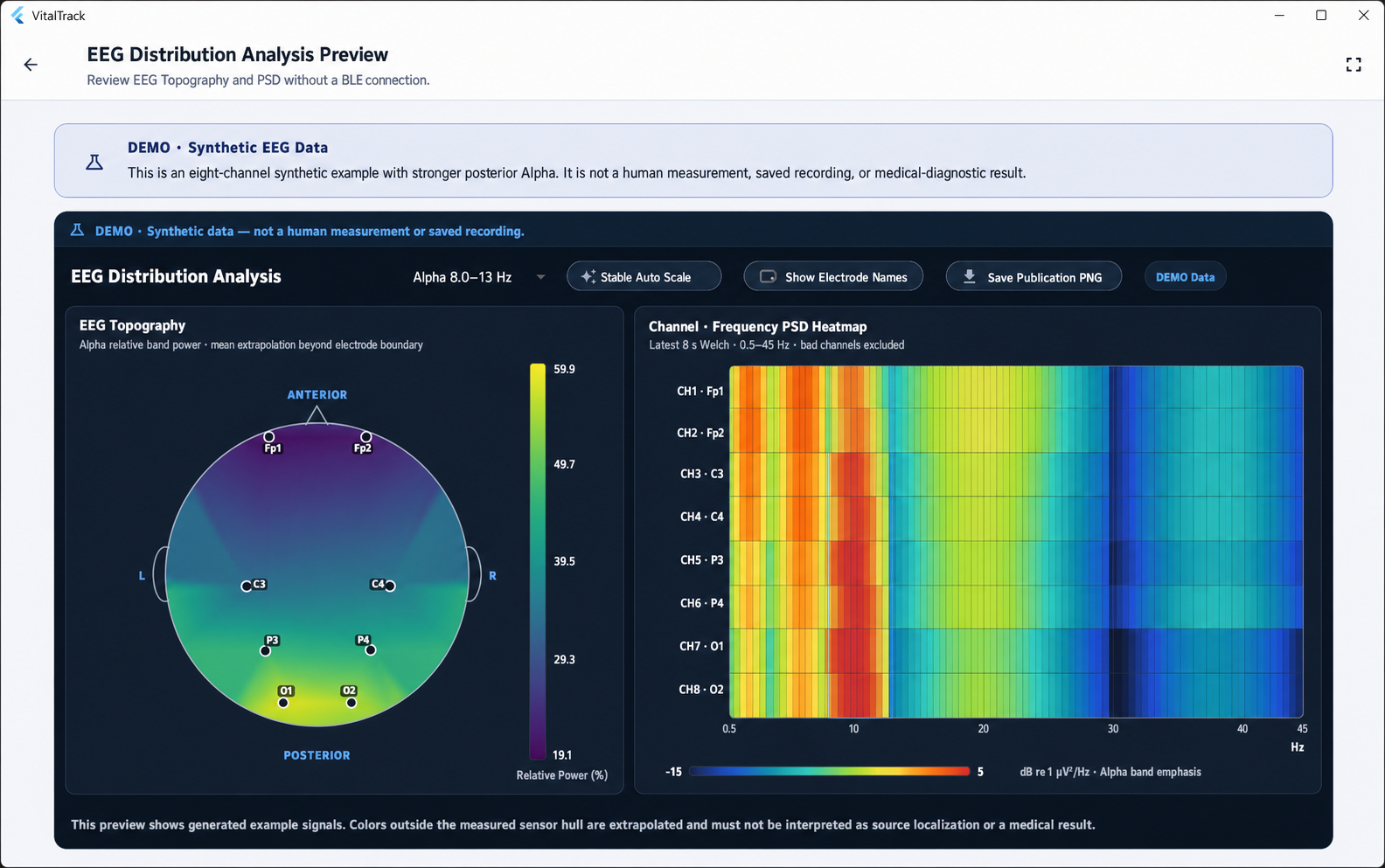 EEG distribution analysis preview in the VitalTrack EEG app